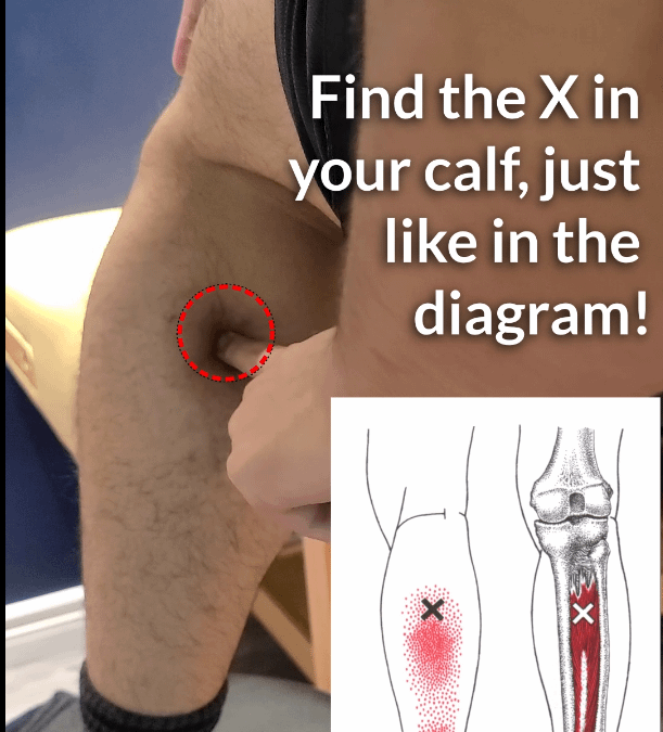 Pain in your Calf?