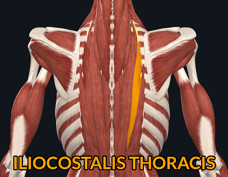 Iliocostalis Thoracis